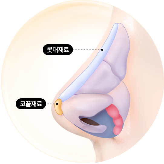 non-implants_nose - 헤이준성형외과