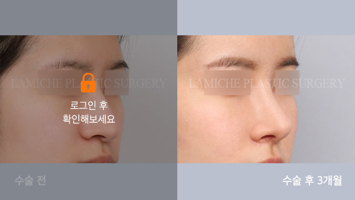 sub1_13367_45도off #image_title
