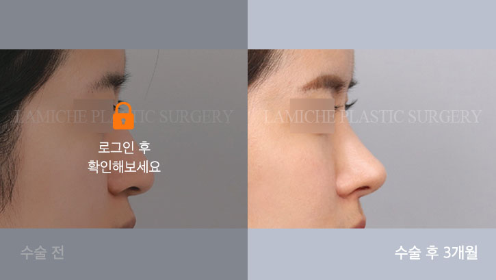 sub1_13367_측면off #image_title