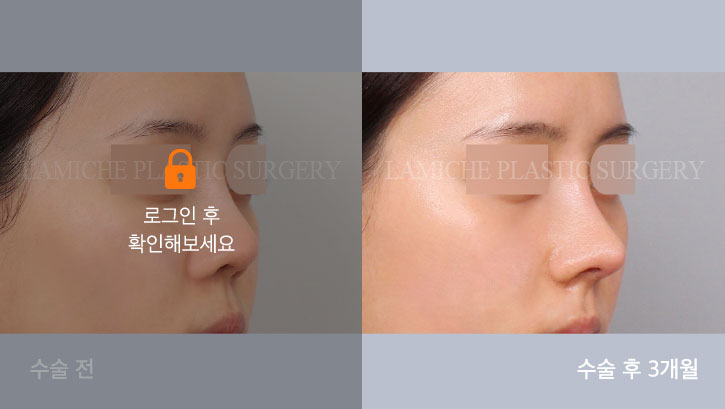 sub1_35038_45도off #image_title