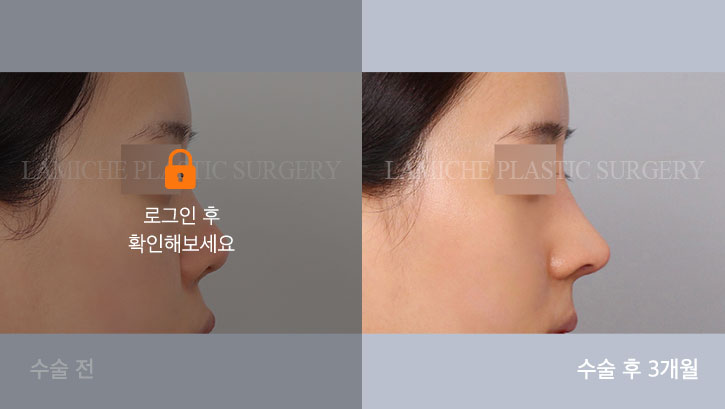 sub1_35038_측면off #image_title
