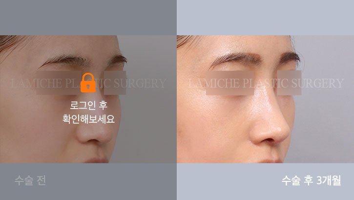 sub2_20670_45도off #image_title