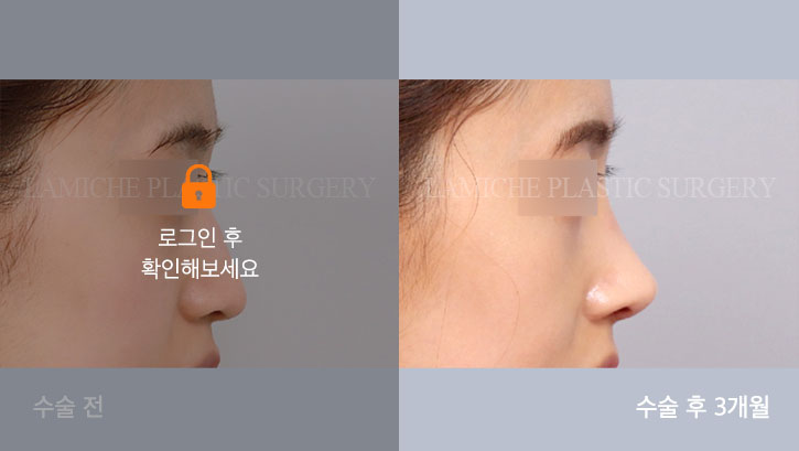 sub2_20670_측면off #image_title