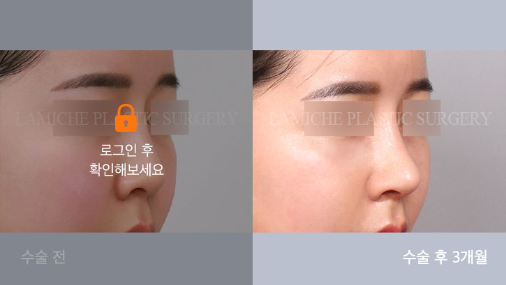 sub2_30670_45도off #image_title