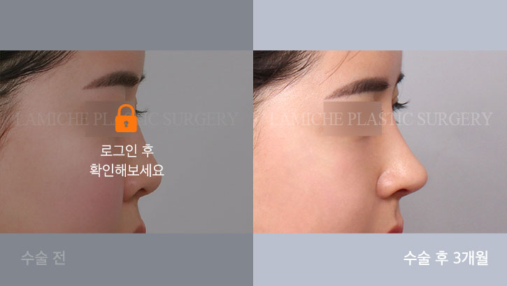 sub2_30670_측면off #image_title