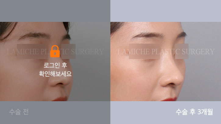 sub3_22627_45도off #image_title