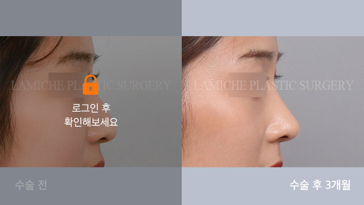 sub3_22627_측면off #image_title