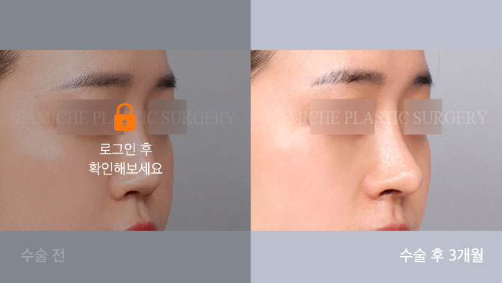 sub3_29216_45도off #image_title