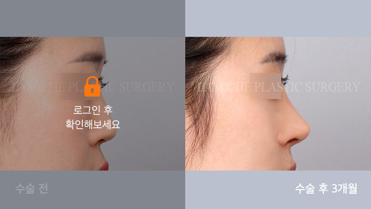 sub3_29216_측면off #image_title