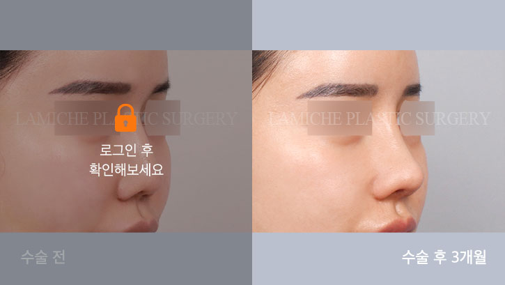 sub4_30336_45도off #image_title