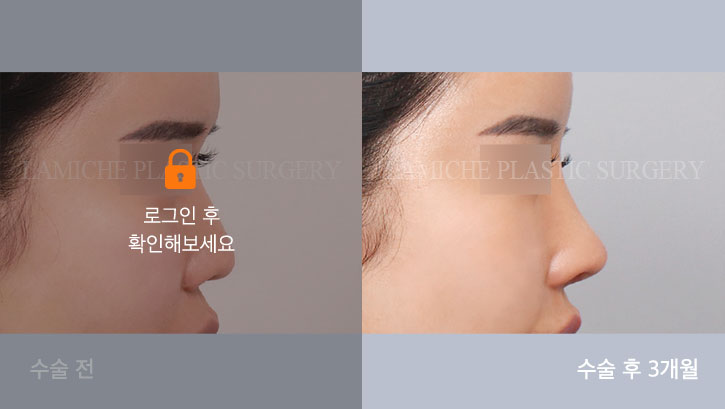 sub4_30336_측면off #image_title
