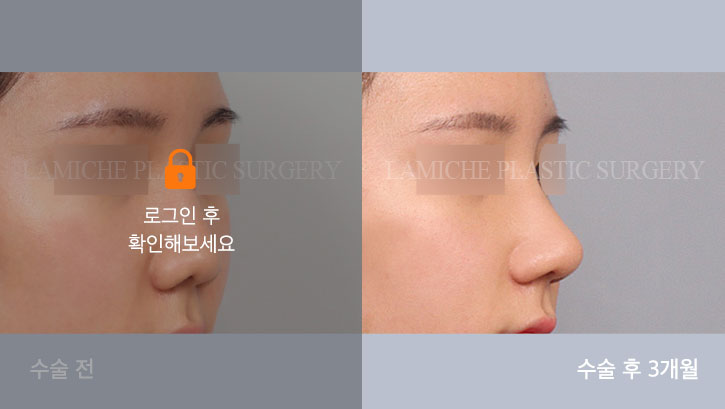 sub4_33285_45도off #image_title
