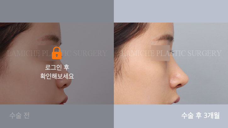 sub5_25185_측면off #image_title