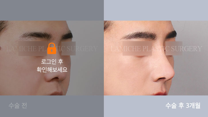 sub5_30906_45도off #image_title