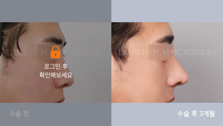 sub5_30906_측면off #image_title
