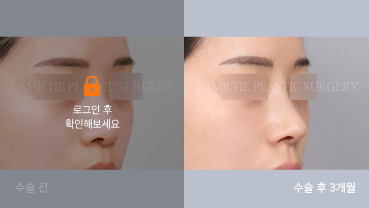 sub6_31627_45도off #image_title