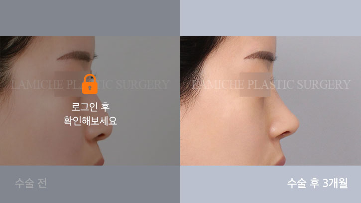 sub6_31627_측면off #image_title