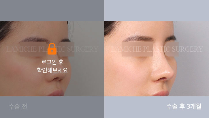 sub6_35943_45도off #image_title