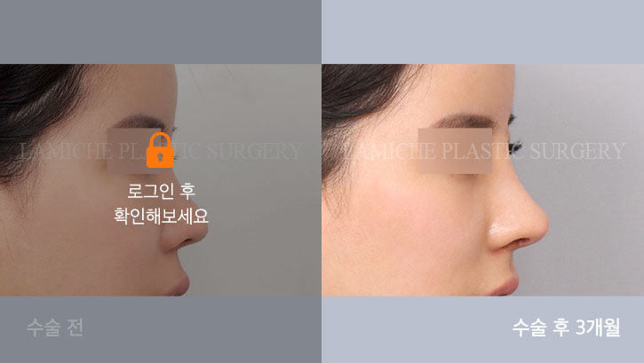 sub6_35943_측면off #image_title