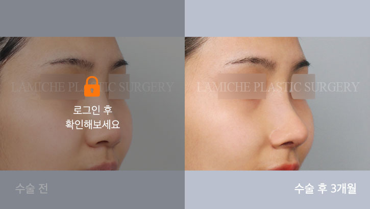 sub7_33410_45도off #image_title