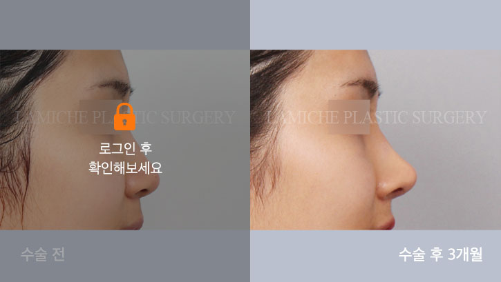 sub7_33410_측면off #image_title