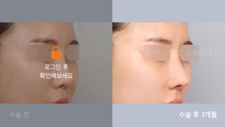 sub7_36430_45도off #image_title