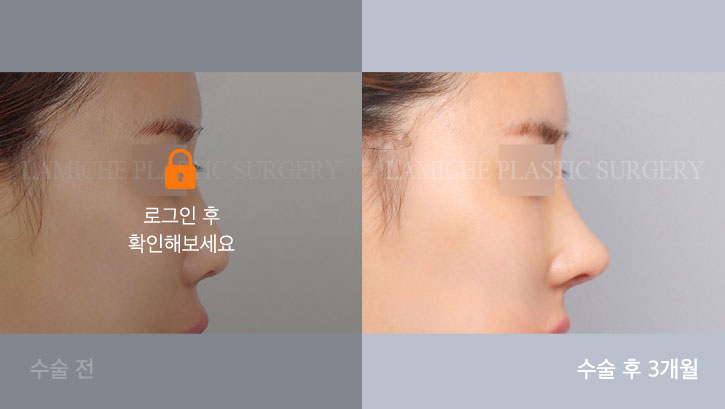 sub7_36430_측면off #image_title