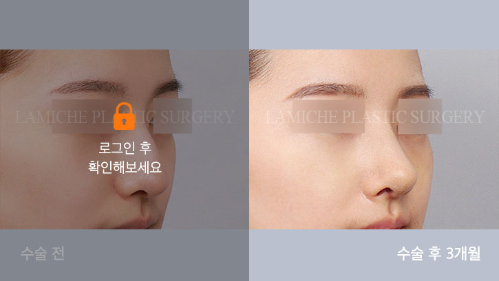 sub8_29577_45도off #image_title