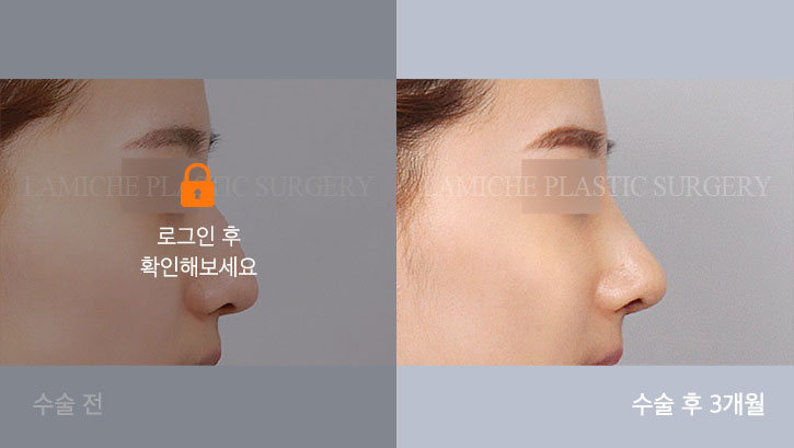 sub8_29577_측면off #image_title