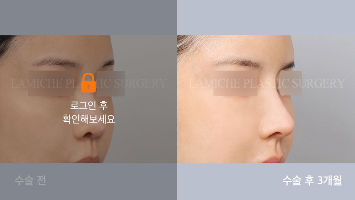 sub8_37061_45도off #image_title