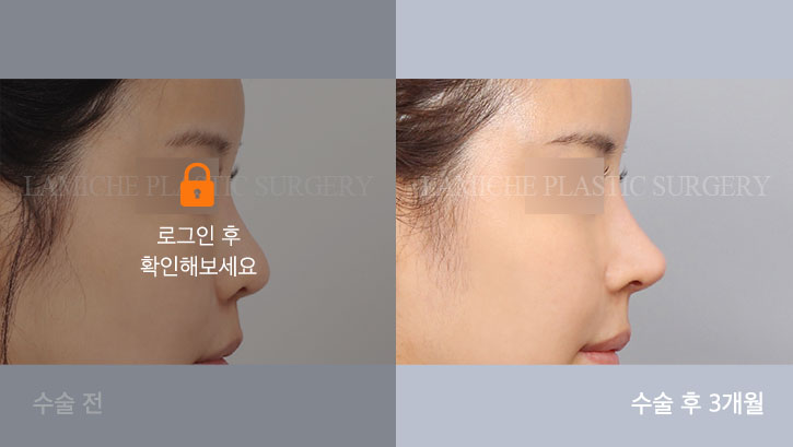 sub8_37061_측면off #image_title
