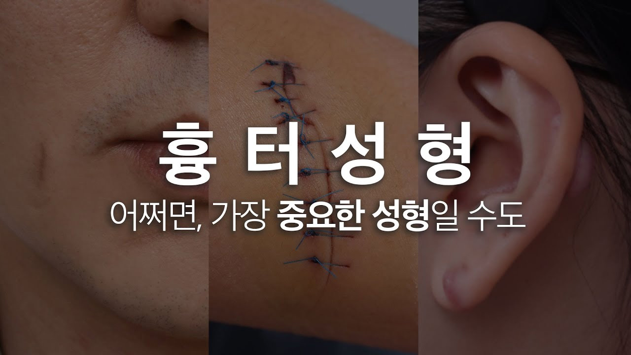 흄터성형-썸네일 - 헤이준성형외과