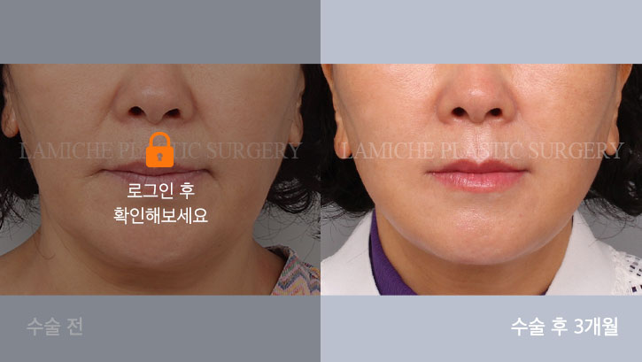 sub1_35213_정면off #image_title