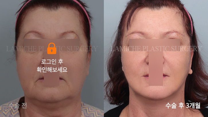 sub1_6869_정면off #image_title