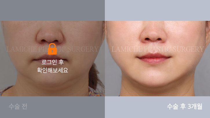 sub2_35427_정면off #image_title