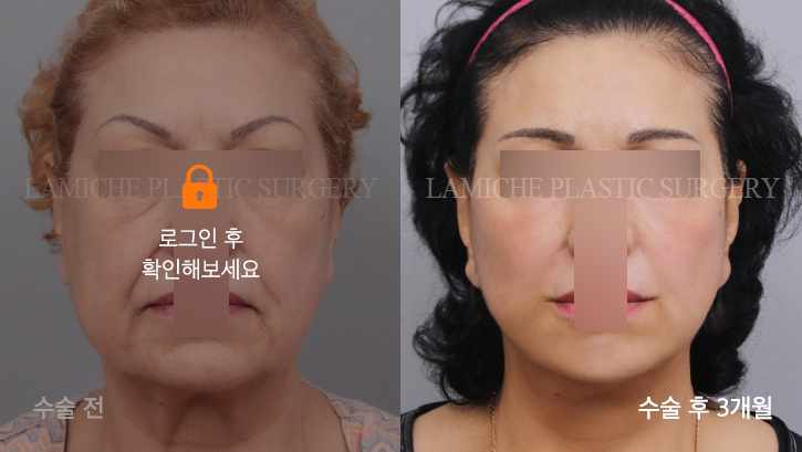sub2_6327_정면off #image_title