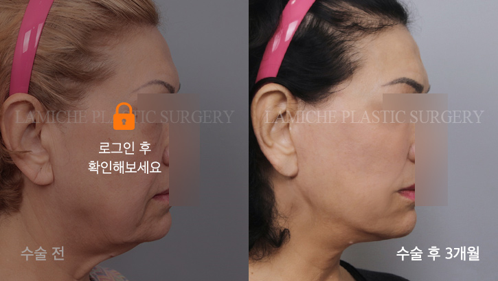 sub2_6327_측면off #image_title